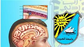 مرض (السحايا) في الأمن والسلامة غداً