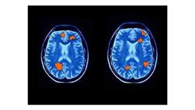 «وليس الذكر كالأنثى».. حقائق.. ونتائج غير متوقعة للمعتقدات الواهمة