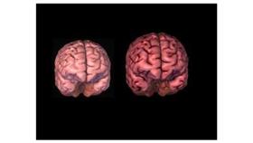 «وليس الذكر كالأنثى».. حقائق.. ونتائج غير متوقعة للمعتقدات الواهمة