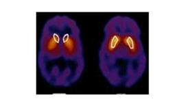 «وليس الذكر كالأنثى».. حقائق.. ونتائج غير متوقعة للمعتقدات الواهمة