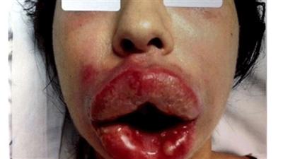 صور صادمة لعمليات تجميل «فشلت»