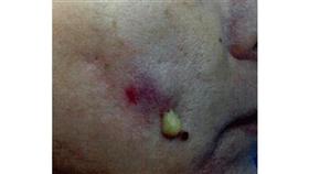 صور صادمة لعمليات تجميل «فشلت»