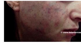 صور صادمة لعمليات تجميل «فشلت»