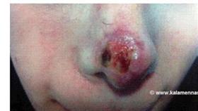 صور صادمة لعمليات تجميل «فشلت»