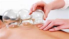صورة تعبيرية  استخدام الحجامة