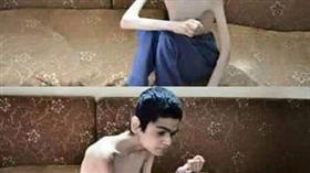 جانب من المعاناة