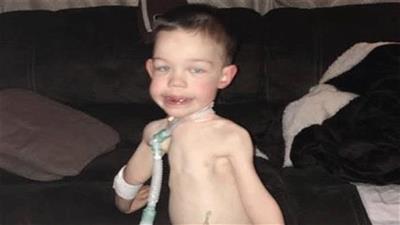 يعاني جوشوا من حالة صحية تجعل جسده يتضاءل مع الزمن