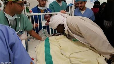 بالفيديو - فريق طبي ينجح في فصل توأم سوداني بالسعودية