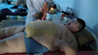 يُعالج لي هانغ بالنار للتخلص من الوزن الزائد
