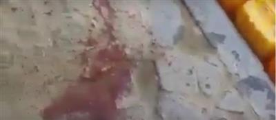 بالفيديو - الحوثيين يقصفون تجمع لأطفال ونساء عند خزان مياه في اليمن