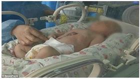 بالفيديو - لحظات مؤثرة لطفل ولد بقلب خارج بطنه