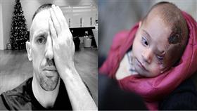 العالم يتضامن مع الرضيع السوري «كريم»