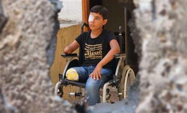 الصحة العالمية: نحو 42 ألف شخص في غزة يعانون إصابات تغير مجرى الحياة