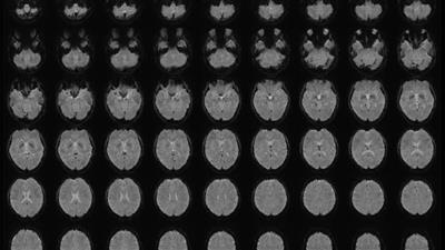 تقنية يابانية جديدة تترجم الصور الذهنية إلى نصوص باستخدام الذكاء الاصطناعي