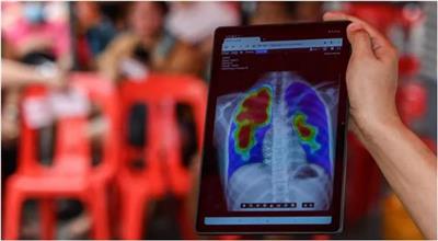 إنفوغرافيك - تعرّف على «أخطر الأمراض المعدية فتكاً» في العالم